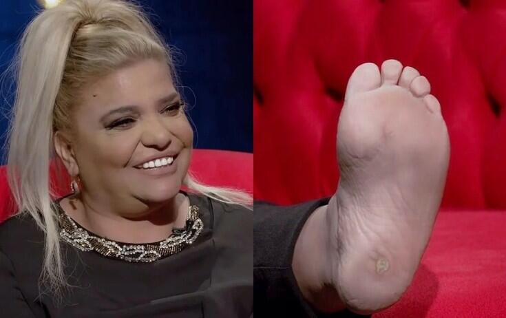 Kibariyənin ayağı sosial mediada g&uuml;ndəm oldu