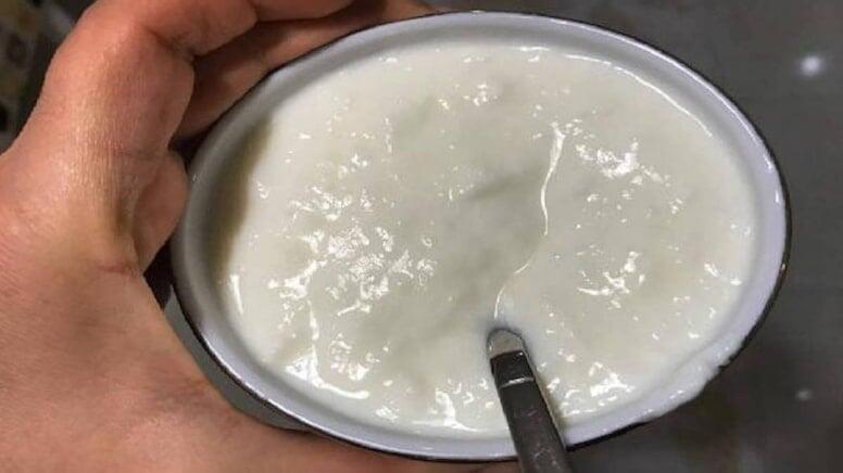 Damarları a&ccedil;ır, &ouml;d kisəsini təmizləyir: Mətbəxinizdəki m&ouml;c&uuml;zəvi ikili