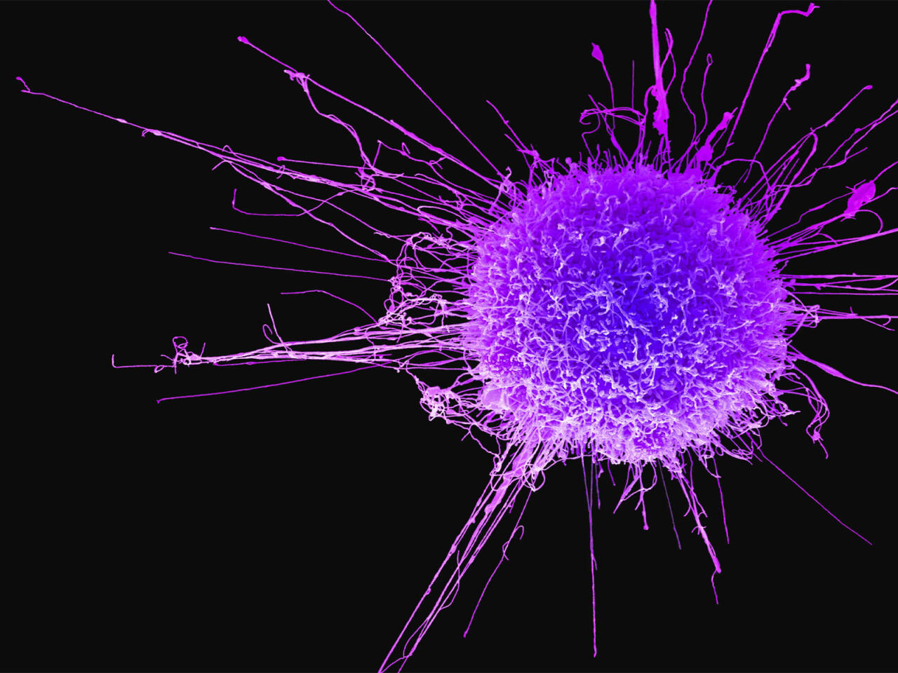 Bu qidalar bağırsaq xər&ccedil;ənginin d&uuml;şmənidir