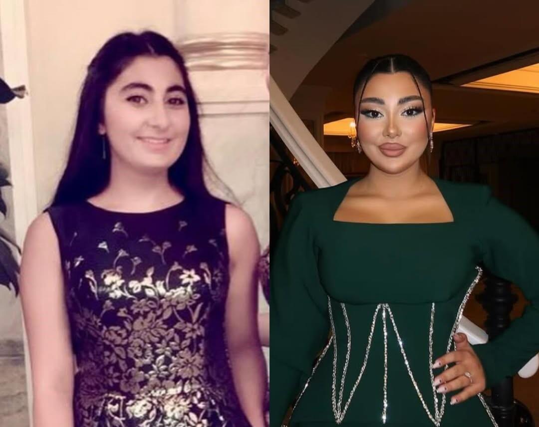 Azərbaycanlı bloqerlərin 10 ildə g&ouml;r&uuml;n&uuml;ş&uuml;ndəki dəyişikliklər DİQQƏT &Ccedil;ƏKDİ 