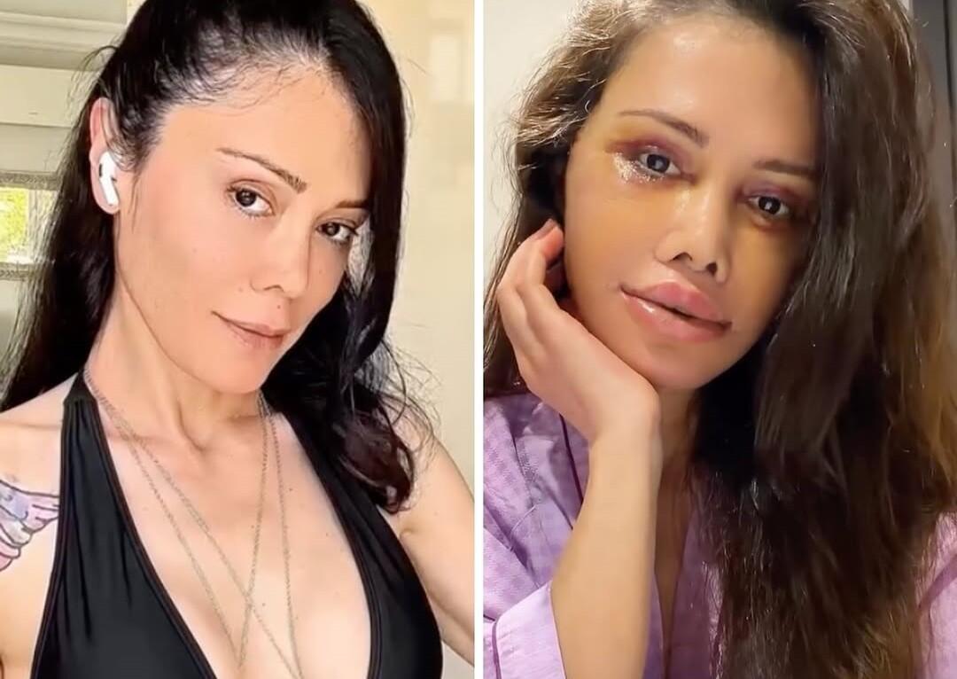 Əməliyyatla &uuml;z&uuml;n&uuml; dəyişdirdi, tanınmaz hala d&uuml;şd&uuml; 