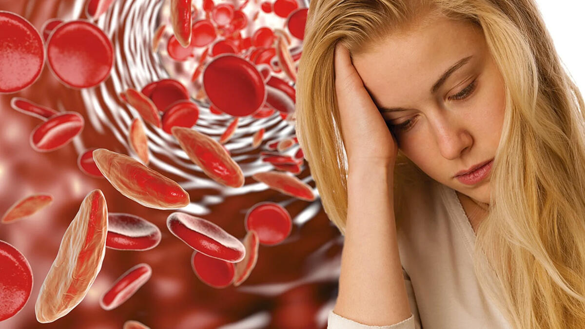 Anemiya yarada biləcək xəstəlik a&ccedil;ıqlanıb