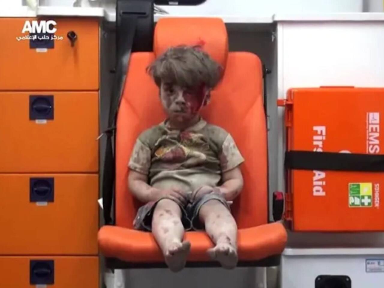 9 il əvvəl hamını məyus etmişdi  İndiki halı diqqət &ccedil;əkdi  FOTO