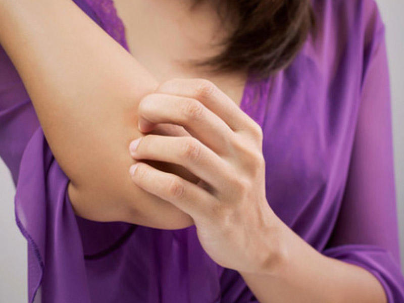 Dəri niyə qaşınır? &ndash; 15 ən yayılmış səbəb