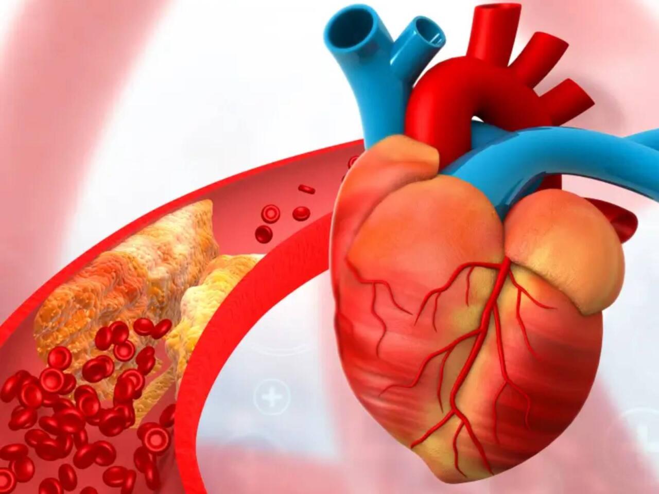 Duz, alkoloq, qəhvəni eyni vaxtda qəbul etmək olmaz  Damarlar d&ouml;zməyəcək