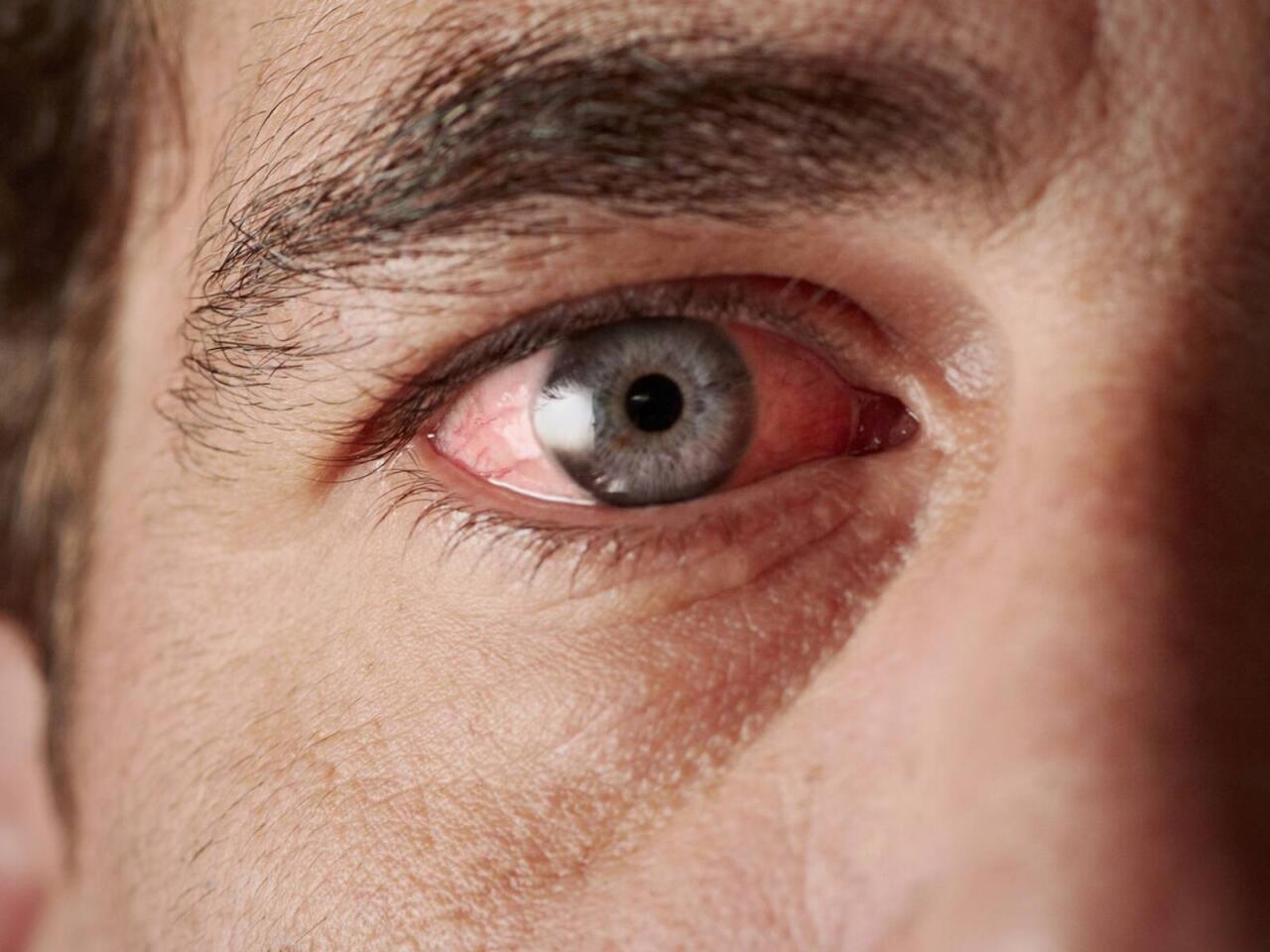 Gərginsinizsə bu vitamininiz &ccedil;atışmır