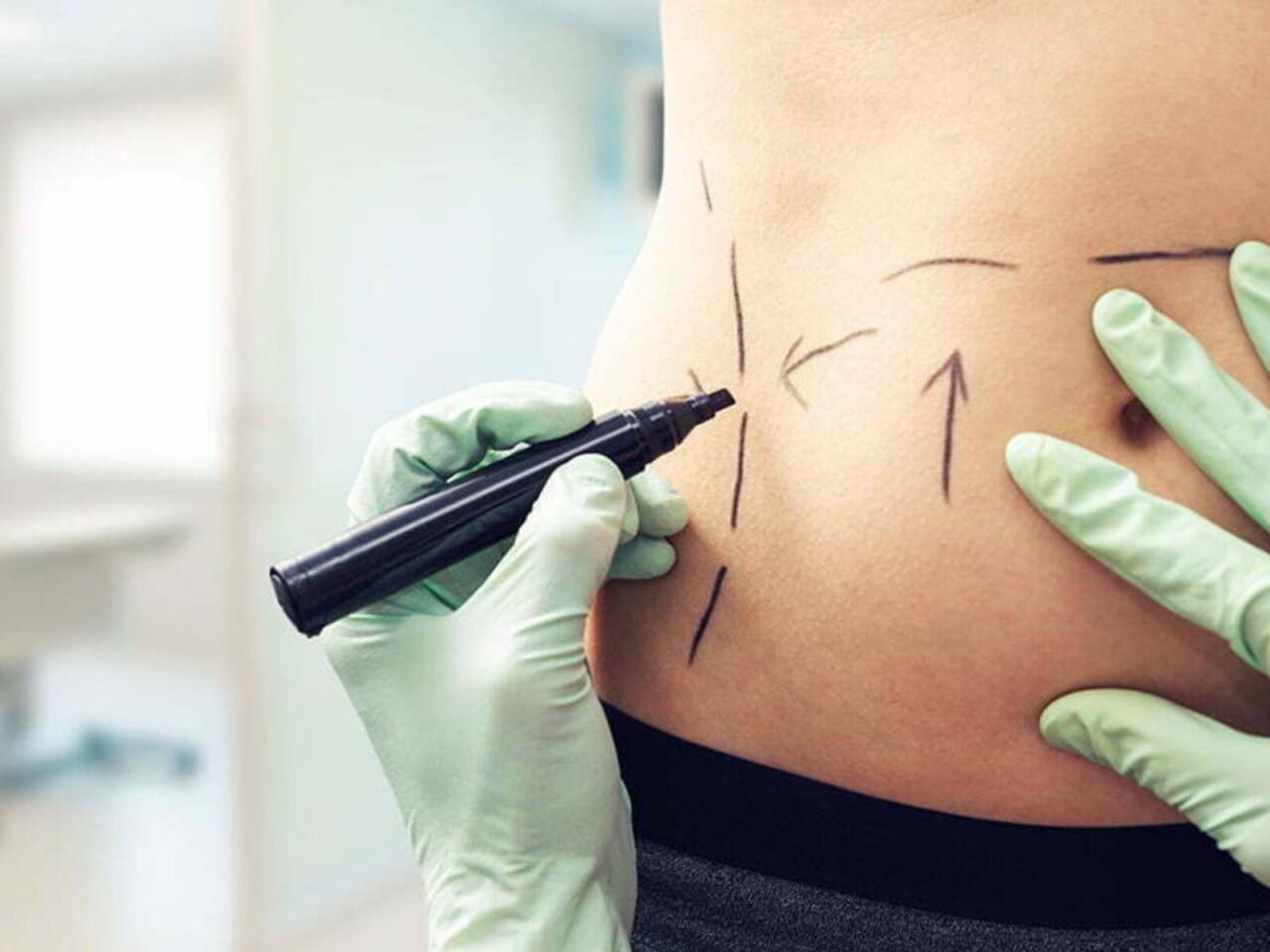 Sevgilisinin "dar gün" üçün yığdığı 140 min dollarını gizlicə estetik əməliyyatlara xərclədi