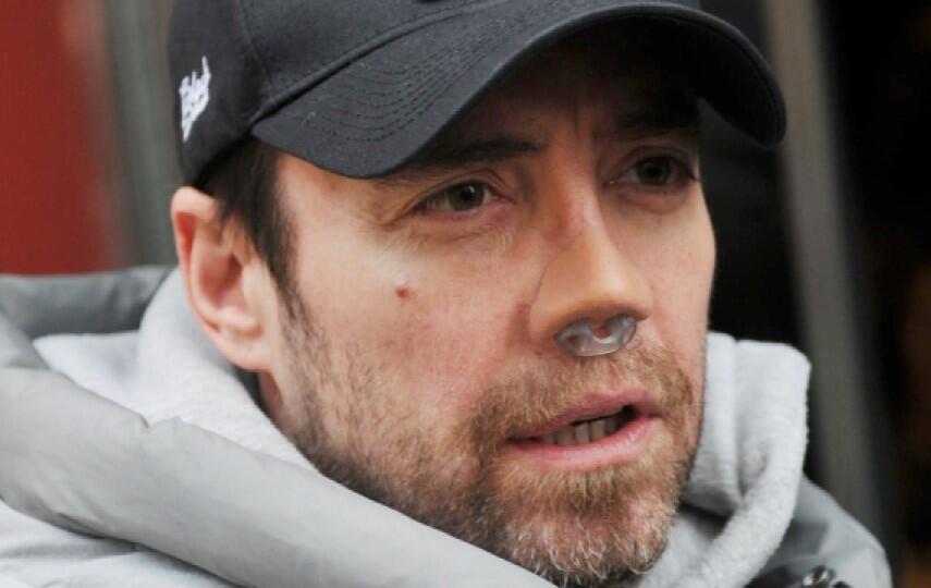 Məşhur m&uuml;ğənni 13c&uuml; dəfə burun əməliyyatı ke&ccedil;irdi 