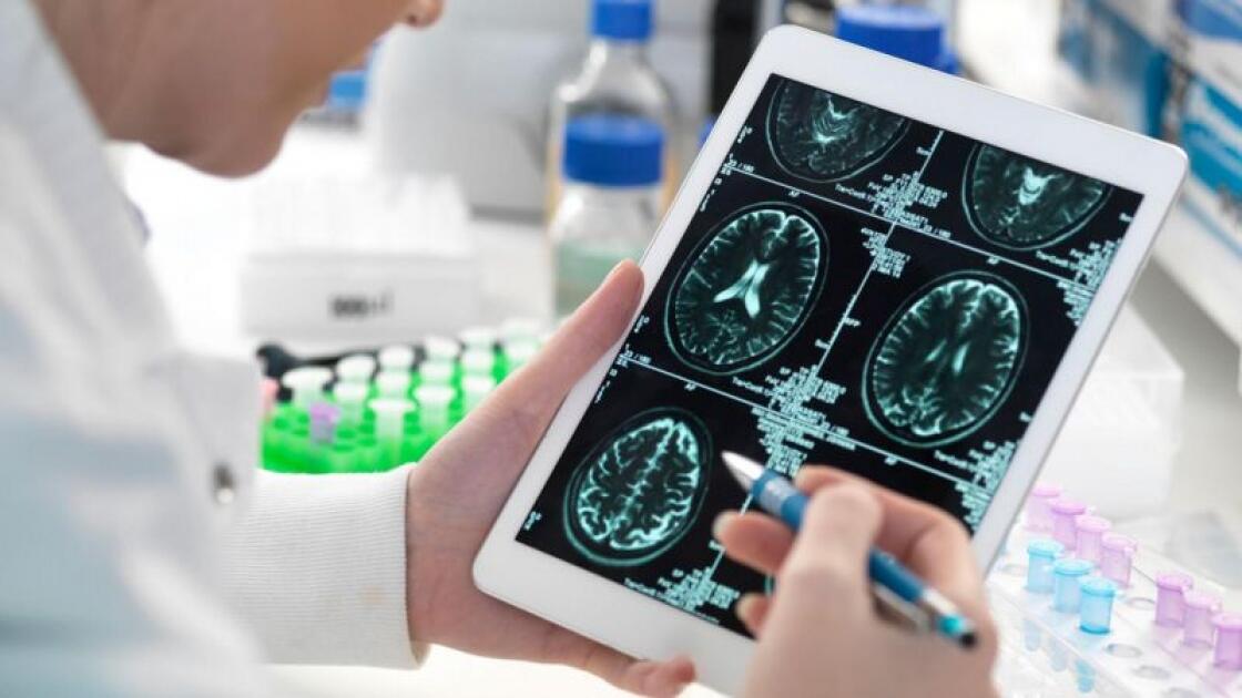 Alzheimerlə m&uuml;barizədə yeni &uuml;mid