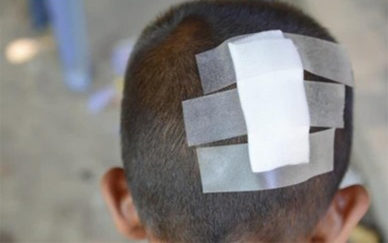 Hesaba görə kafe sahibi ilə mübahisə etdi, 6 yaşlı oğlu başından zərbə aldı