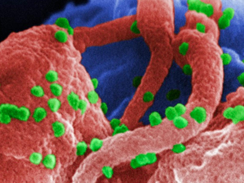 Yaşlı h&uuml;ceyrələri yenidən cavanlaşdırmaq m&uuml;mk&uuml;n olacaq
