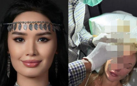 Qazaxıstanlı model rus bloqeri amansızcasına d&ouml;yd&uuml; 