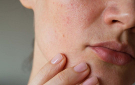 Dəri xər&ccedil;əngindən bu sadə &uuml;sulla qorunmaq olar