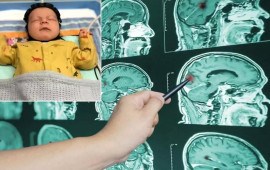 Elmdə inqilab  Möcüzəvi başlıq ixtira olundu