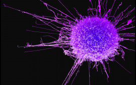 Bu qidalar bağırsaq xər&ccedil;ənginin d&uuml;şmənidir