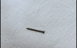 Bakıda azyaşlının mədəsindən mismar &ccedil;ıxarıldı  FOTO