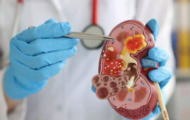 Səhər vərdişləri b&ouml;yrəklərinizi məhv edə bilər &ndash; 5 təhl&uuml;kəli səhv