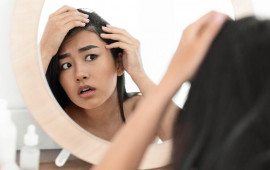 Sa&ccedil; t&ouml;k&uuml;lməsinə səbəb olan 9 m&uuml;h&uuml;m faktor &ndash;