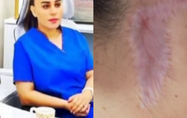 &ldquo;Məni g&ouml;zəllik salonunda əməliyyat etdi, ağzım əyilir&rdquo; 