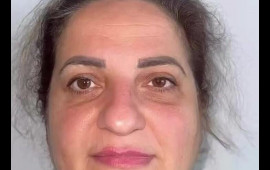 60 yaşlı qadın əməliyyatla 30 yaş CAVANLAŞDI 