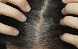 Sa&ccedil;lar niyə vaxtından tez ağarır?  Stresslə əlaqəsi yoxdur