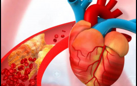 Duz, alkoloq, qəhvəni eyni vaxtda qəbul etmək olmaz  Damarlar d&ouml;zməyəcək