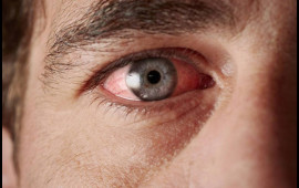 Gərginsinizsə bu vitamininiz &ccedil;atışmır