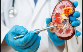 B&ouml;yrək daşlarının yaranmasına səbəb olan qidalar a&ccedil;ıqlandı