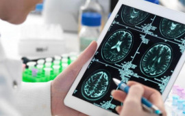 Alzheimerlə m&uuml;barizədə yeni &uuml;mid