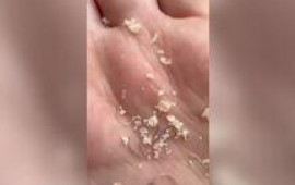 "Araz" marketdən alınan "Binə" &ccedil;&ouml;rəyindən simlər &ccedil;ıxdı 