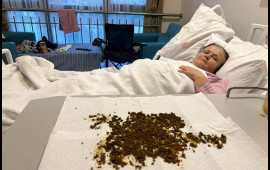 Qarın ağrısından şikayət etdi, &ouml;d&uuml;ndən 20 mindən &ccedil;ox daş &ccedil;ıxdı 