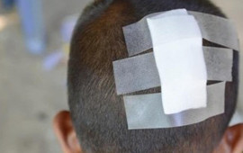 Hesaba görə kafe sahibi ilə mübahisə etdi, 6 yaşlı oğlu başından zərbə aldı