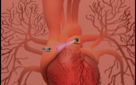 Robot ağrıkəsicilər hazırlandı  Toxumanı tapıb sağaldır, sonra da yox olur