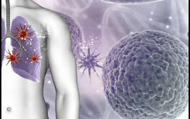 Azı g&uuml;ndə 3 dəfə yeyirik  Ağciyər xər&ccedil;əngi yaradır