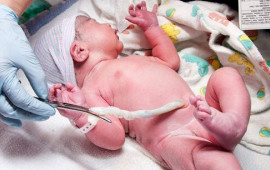 62 yaşlı t&uuml;rk m&uuml;ğənni &ouml;z&uuml;n&uuml; k&ouml;rpə g&ouml;bəyi ilə CAVANLAŞDIRDI 