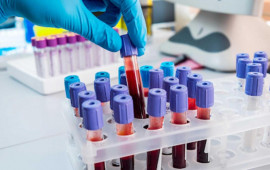 "Qızıl qan": D&uuml;nyada cəmi 50 nəfərdə olan ən nadir qan qrupu niyə vacibdir?