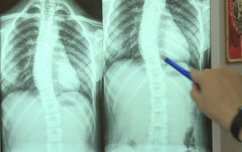 Son zamanlar “812” yaş arası uşaqlarda bel və boyun ağrılarının səbəbi